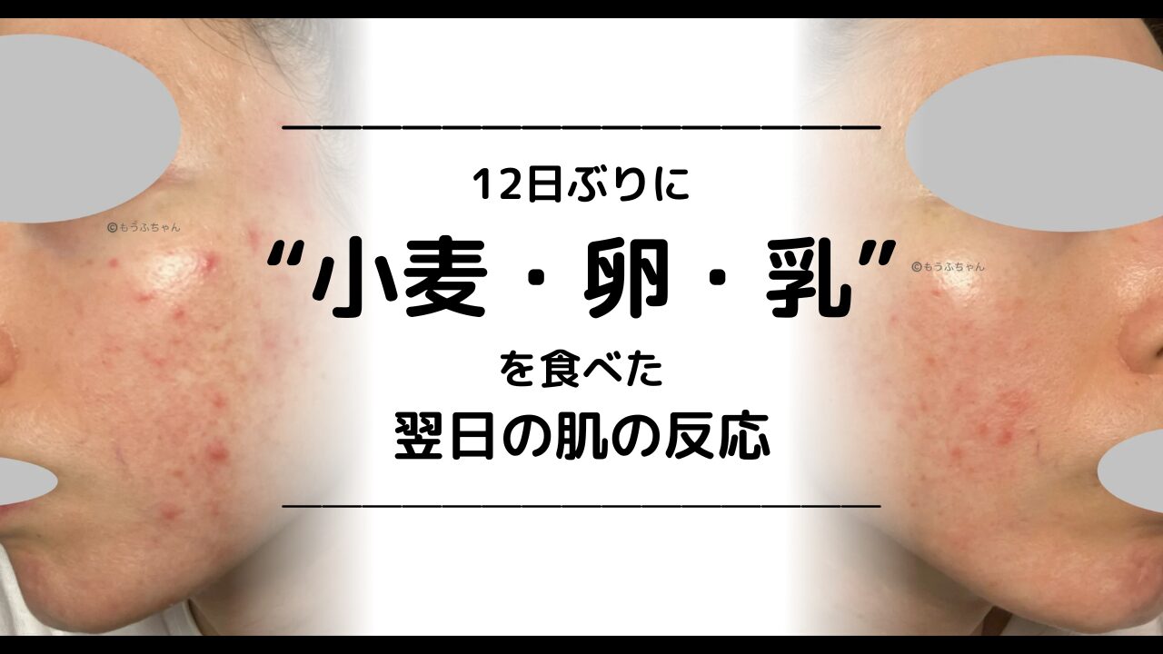 小麦 卵 乳 反応