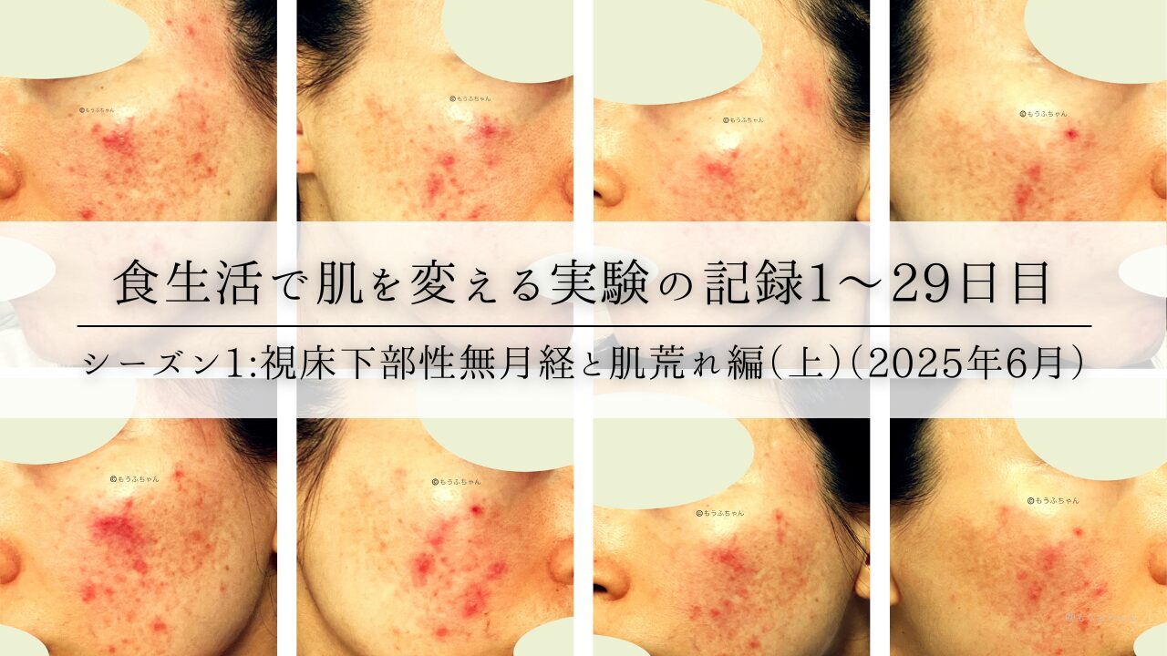 食生活で肌を変える実験の記録1〜29日目|シーズン1:視床下部性無月経と肌荒れ編(上)(2025年6月)