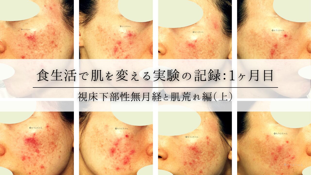 食生活で肌を変える実験の記録：１ヶ月目