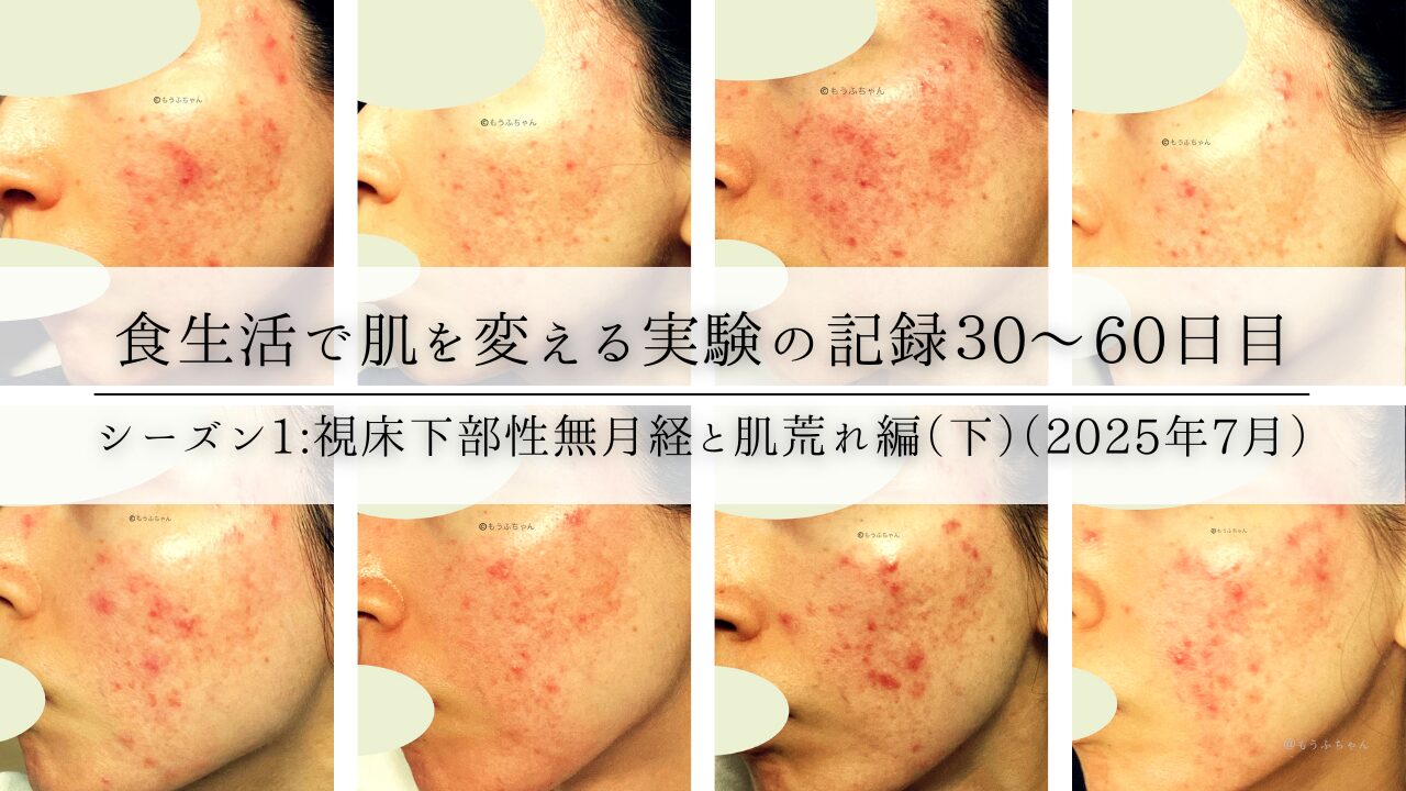 食生活で肌を変える実験の記録30〜60日目|シーズン1:視床下部性無月経と肌荒れ編(下)(2025年7月)