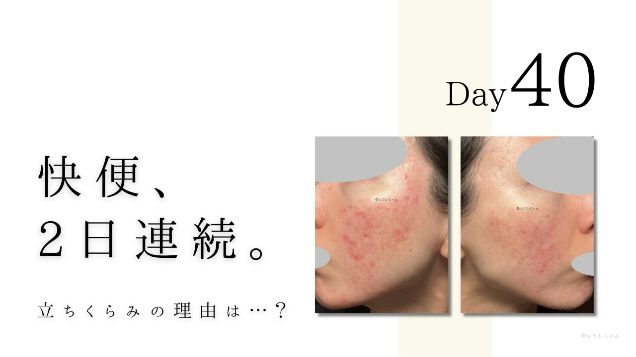 快便2日連続！ 立ちくらみの理由は…？