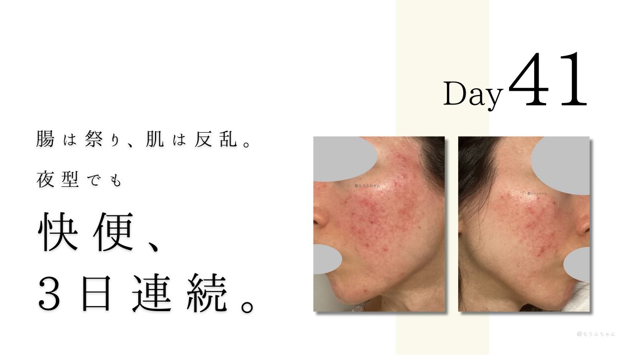 腸は祭り、肌は反乱。夜型でも快便3日連続
