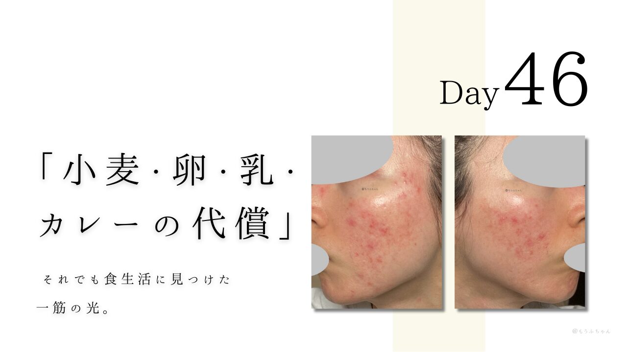「小麦・卵・乳・ カレーの代償」 それでも食生活に見つけた 一筋の光。