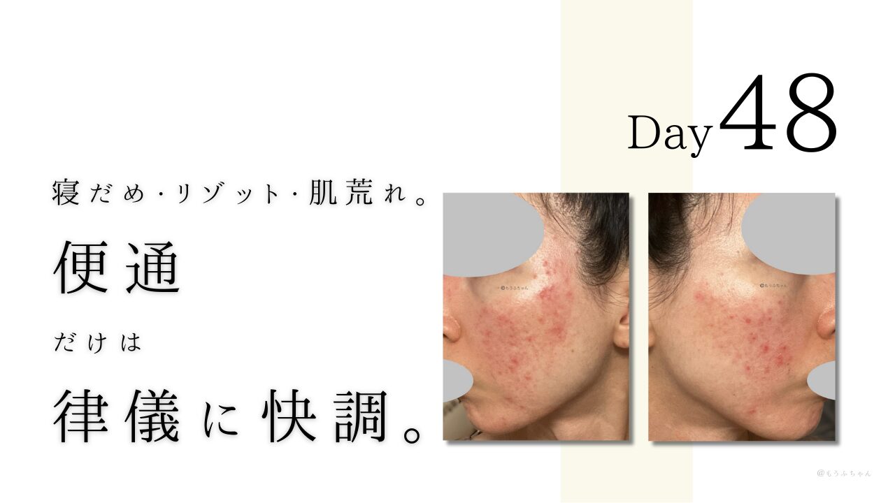 寝だめ・リゾット・肌荒れ。 便通 だけは 律儀に快調。