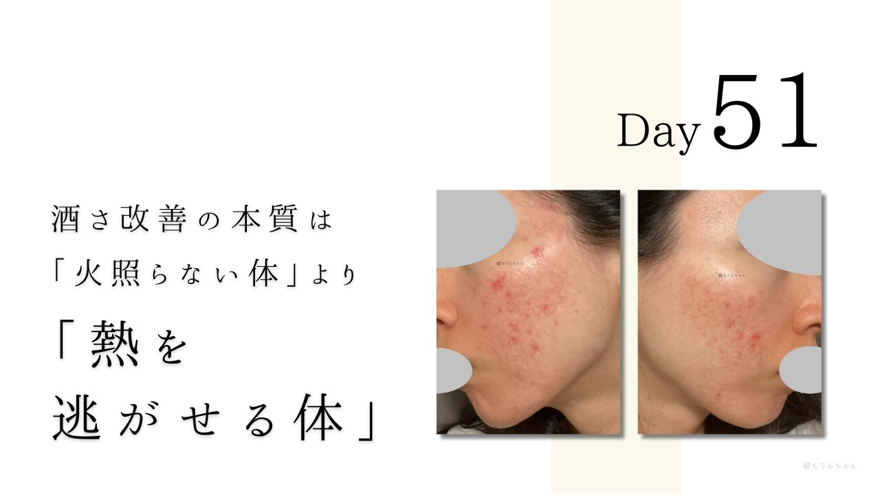 酒さ改善の本質は 「火照らない体」より 「熱を 逃がせる体」