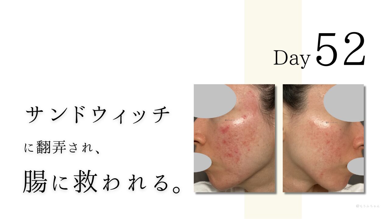 サンドウィッチに翻弄され、腸に救われる。