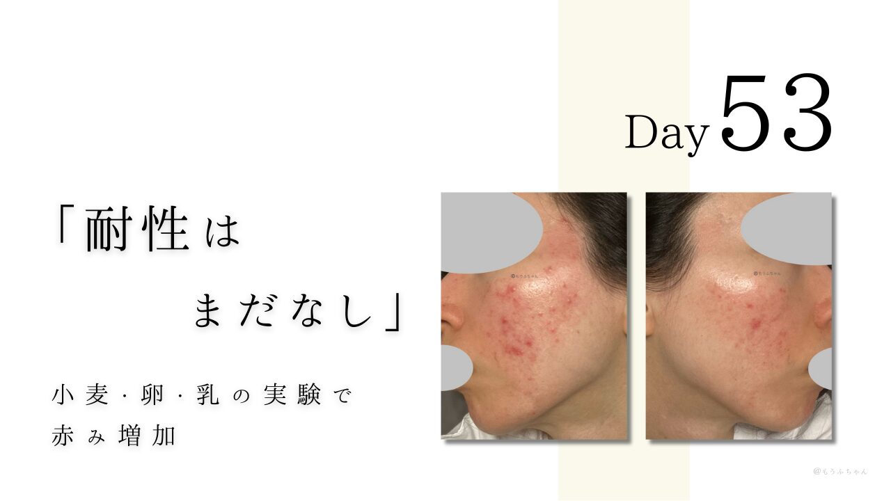 「耐性は まだなし」 小麦・卵・乳の実験で 赤み増加