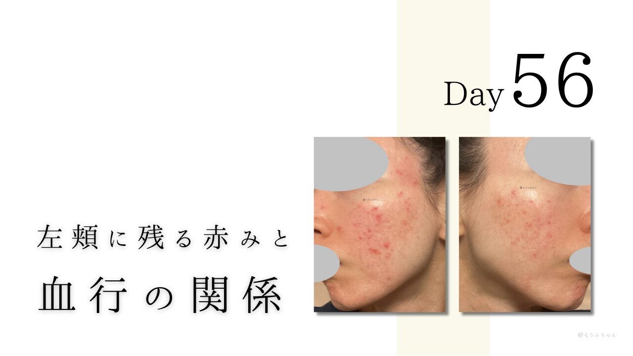 左頬に残る赤みと 血行の関係
