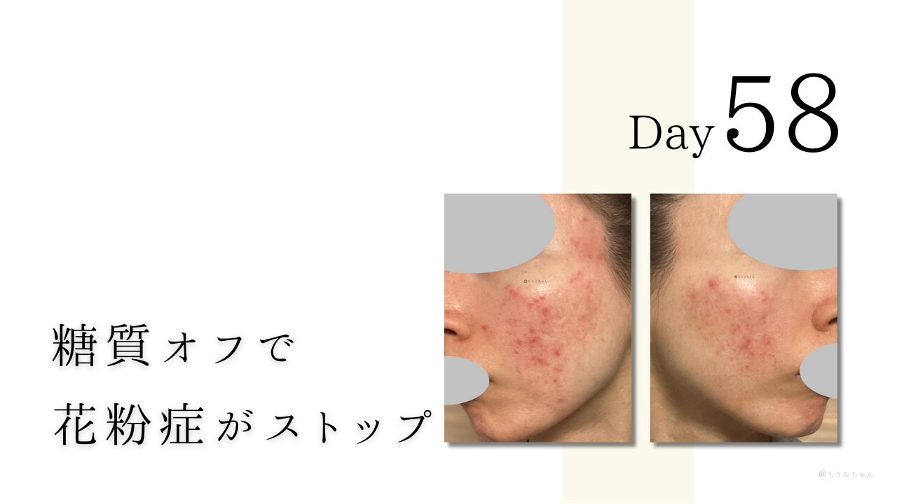 糖質オフで 花粉症がストップ