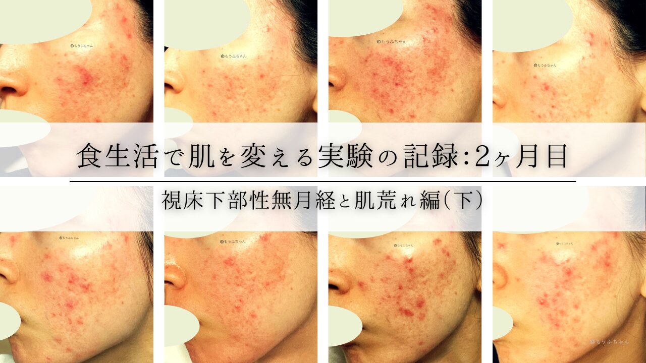食生活で肌を変える実験の記録：2ヶ月目