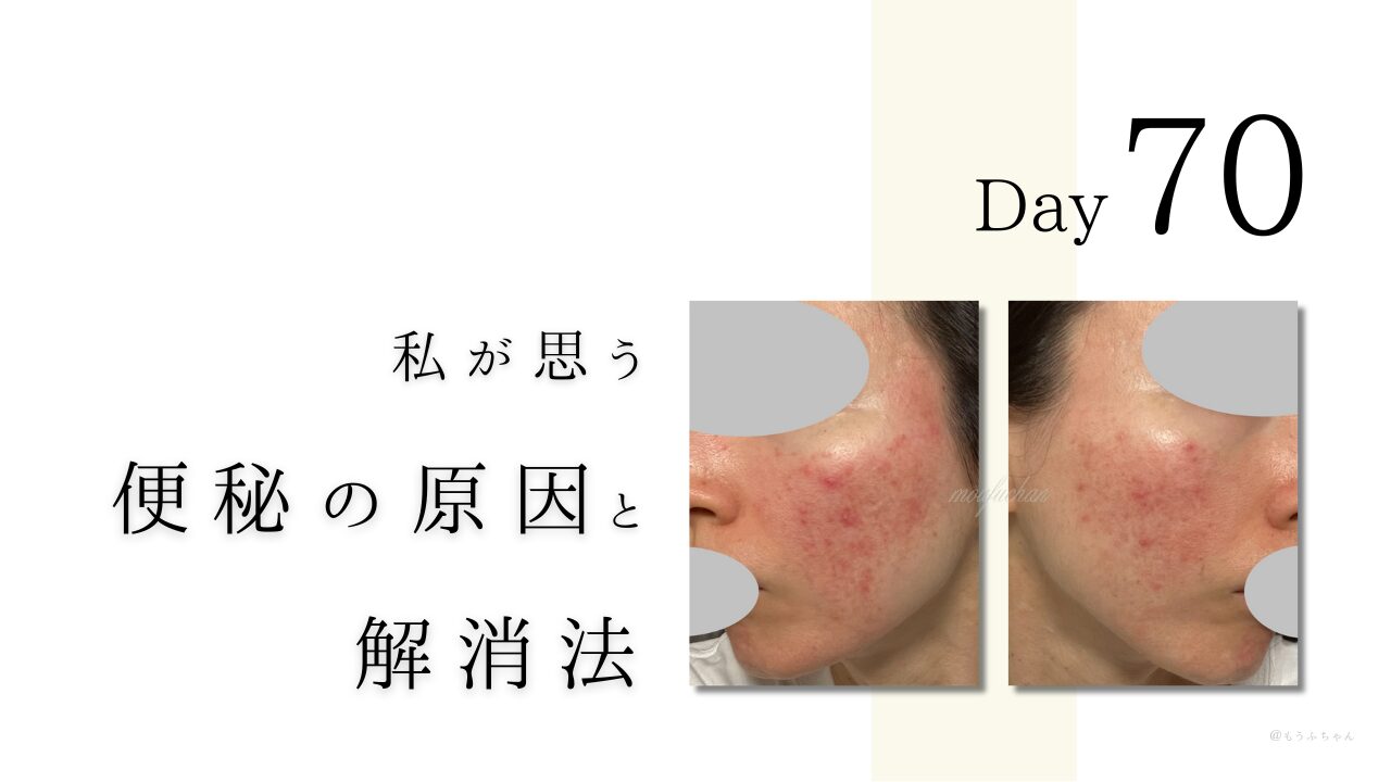 私が思う便秘の原因と解消法