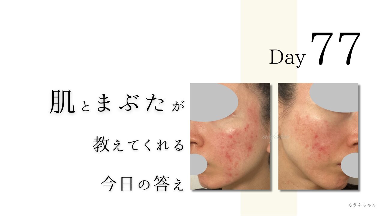 肌とまぶたが教えてくれた今日の答え