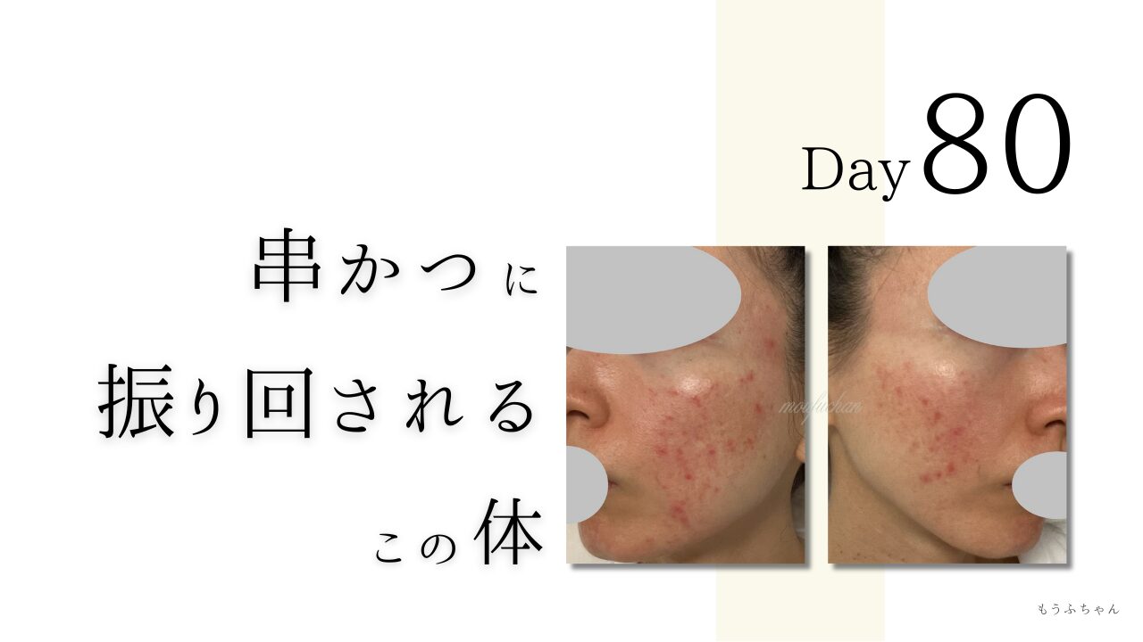 串かつに振り回されるこの体