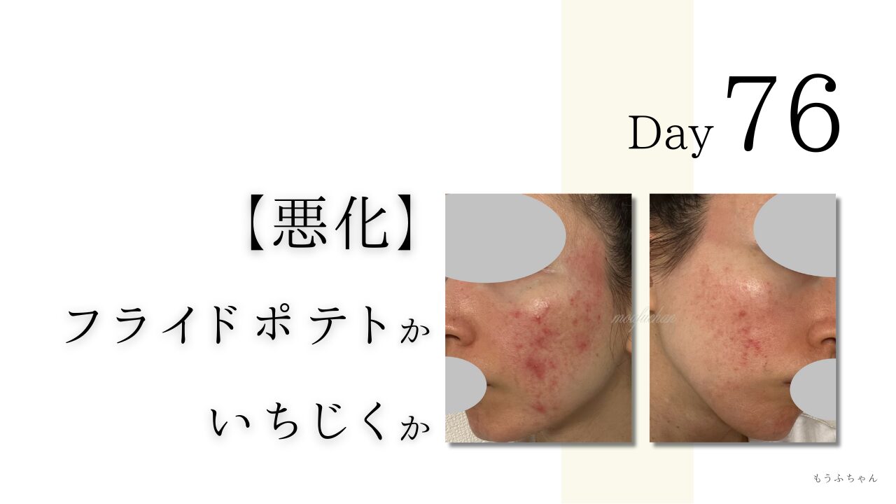 悪化　フライドポテトかいちじくか