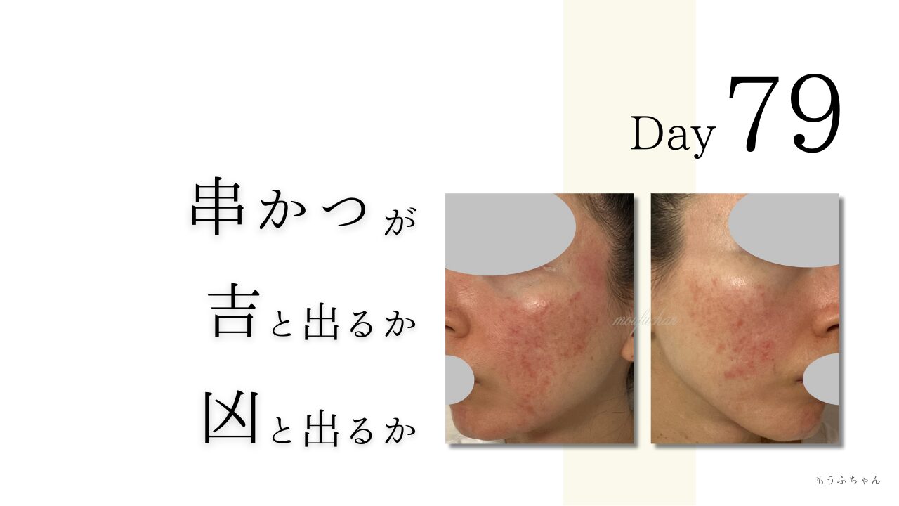 串かつが吉と出るか凶と出るか